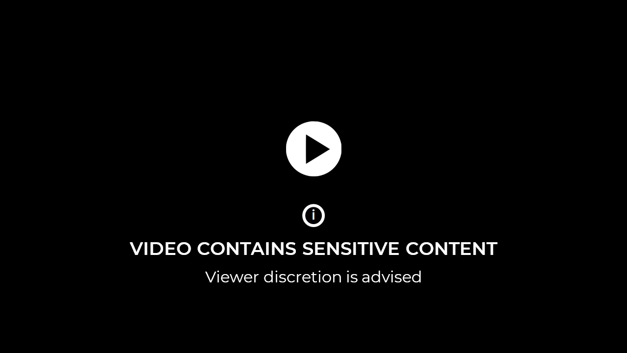 Pengangkatan myoma uterus